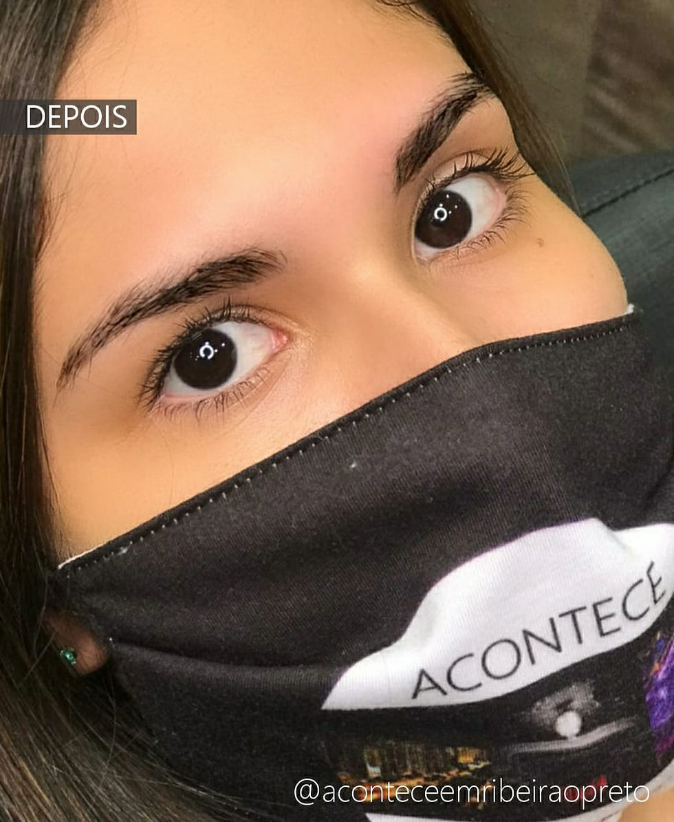 ree