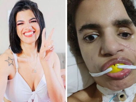 Ana Carolina de 30 anos fica em estado vegetativo após ser agredida pelo ex-marido