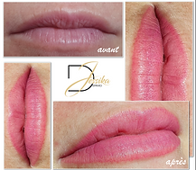 photos avant et aprés lèvres tatouées en maquillage permanent ou semi-permanent