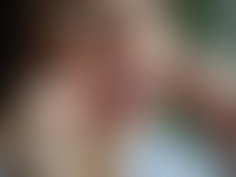 The Overlooked Impact of Tongue Tie and Lip Tie on Breathing and Airway Health