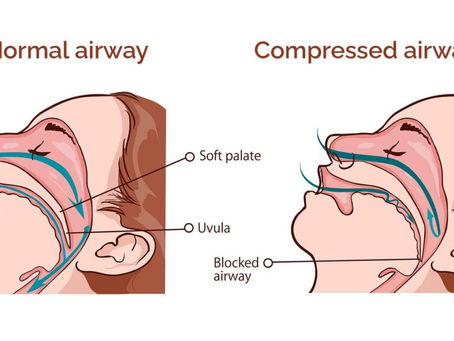 Orthodontics and Sleep: How Jaw Position Can Affect Rest and Recovery