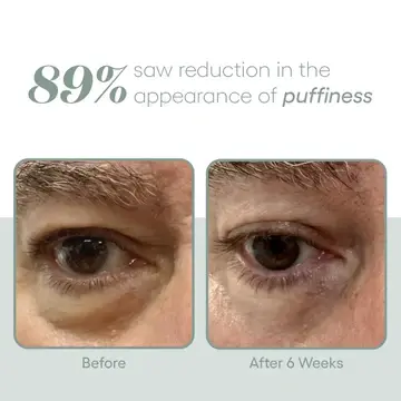 Thumbnail: Plated eye serum