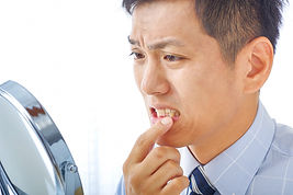 歯ぐきが気になる男性