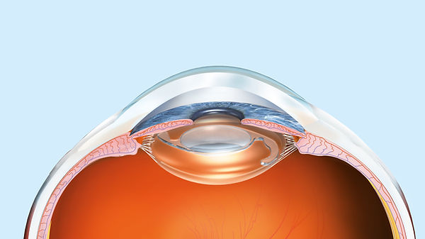 眼球を横から見た術後のイメージ