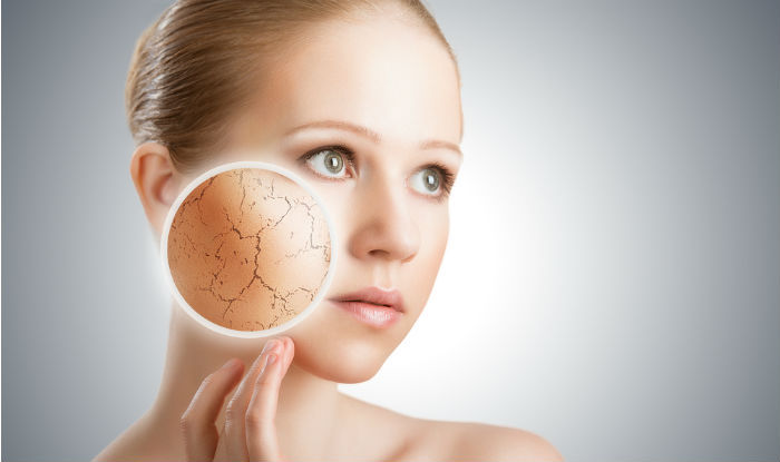dry-skin