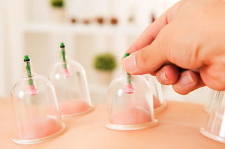 Vacuum-Cupping-Therapy-2.jpg