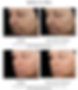 Thumbnail: SKINMEDICA TNS Advanced+ Serum 1oz
