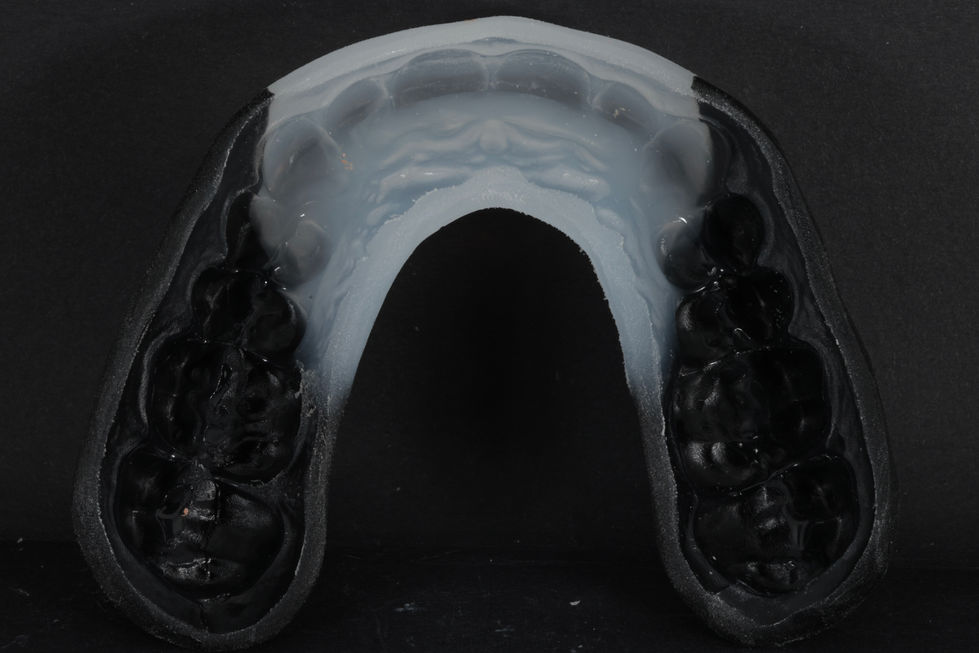 Two colored guard with a perfect fit in the mouth.