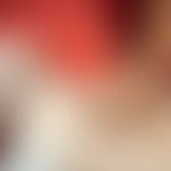 Understanding How Effective Is CPR for Saving Lives