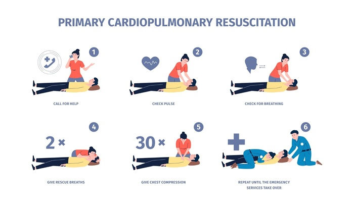 Step-by-Step Guide to Performing 30:2 CPR