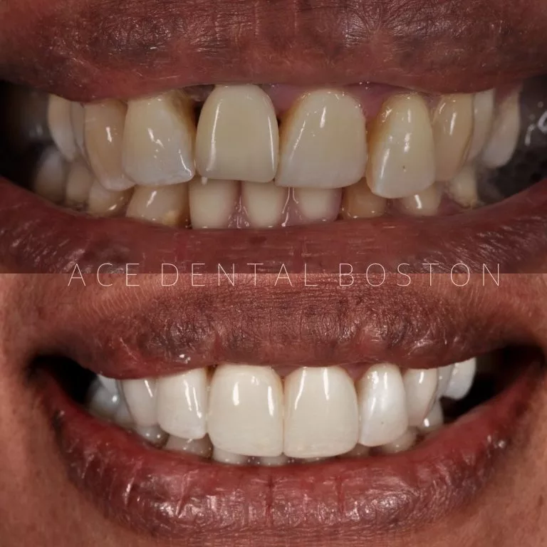 Cosmetic-Dentistry-768x768.webp