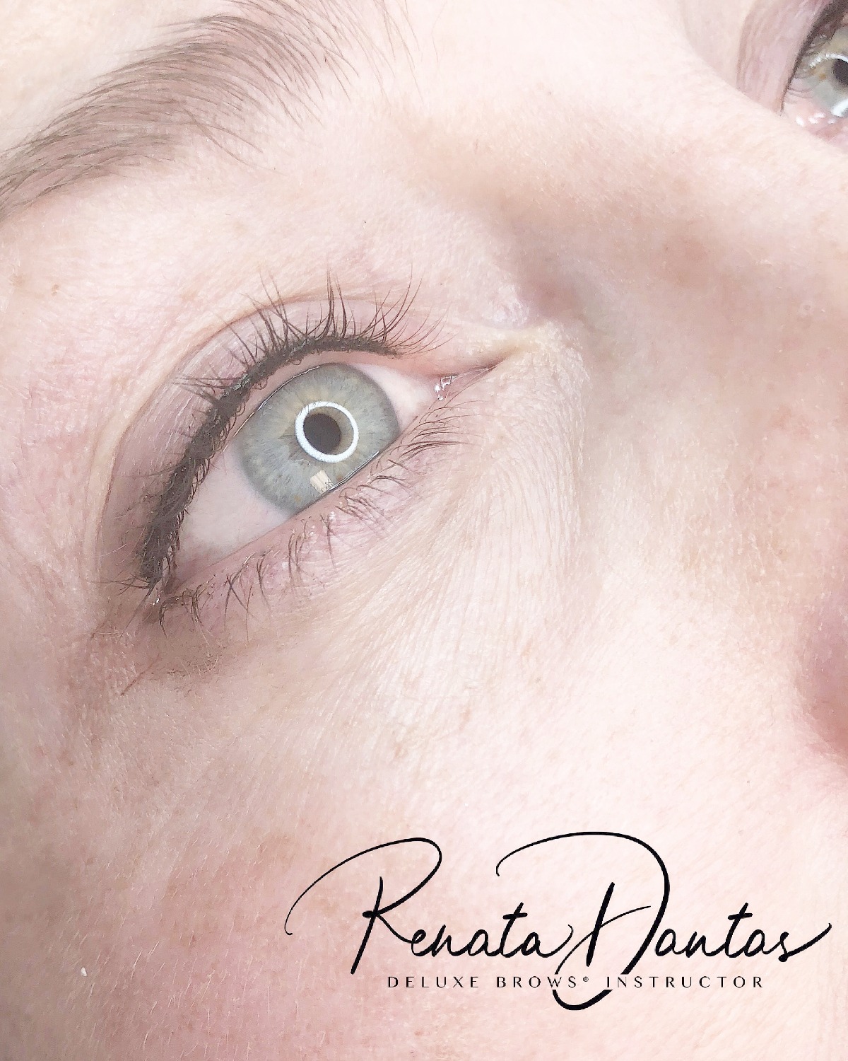 Lash enhancement