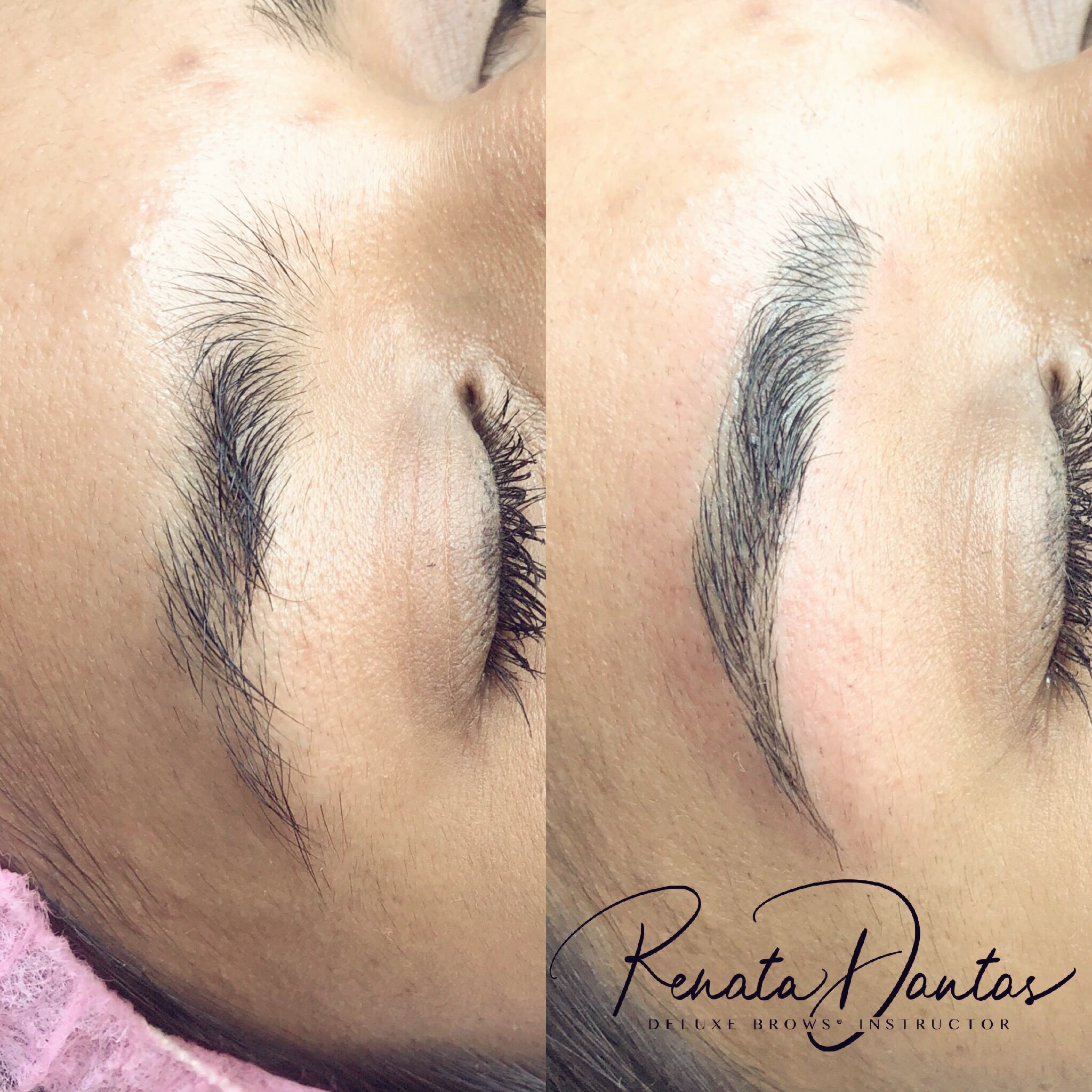 Microblading