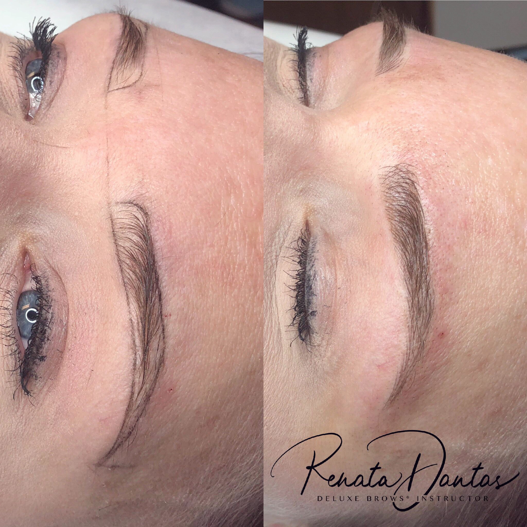 Microblading