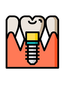 Implantes dentales