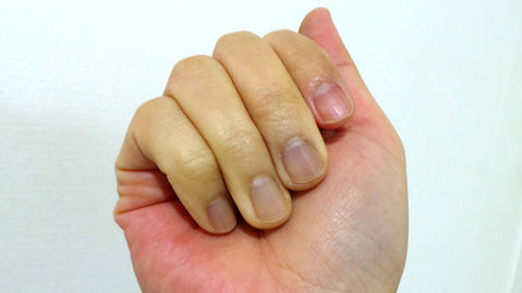 Hand-Arm Vibration Syndrome - Analysing the Subsequent Effects From Exposure