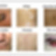 Chart-of-six-common-types-of-skin-disease_Q320.jpg