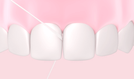How_to_floss_STEP_3, up and down zig-zag