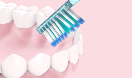 How-to-brush-STEP-3-brushing-front-teeth