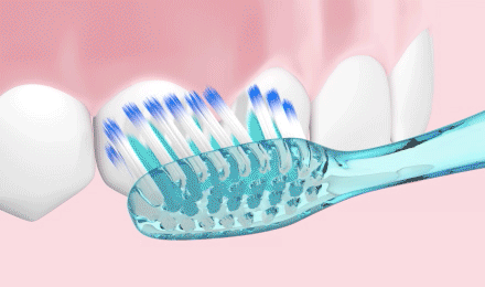 How-to-brush-STEP-2-brush-under-gum-line