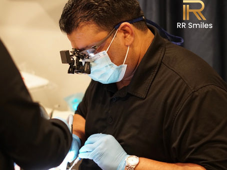 Understand No Prep Veneers: The Guide to a Stunning Smile Without the Drill