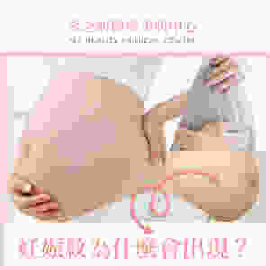 妊娠紋 懷孕 出紋 新手媽咪