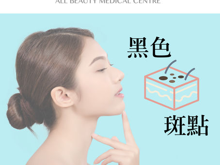 臉上嘅黑色斑點係咪都係色斑?