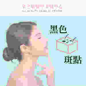 臉上嘅黑色斑點係咪都係色斑 激光打斑 激光去斑 全之妍 ALLBEAUTY Lumenis M22 Fotona激光