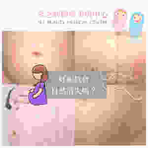 妊娠紋 懷孕 出紋 新手媽咪