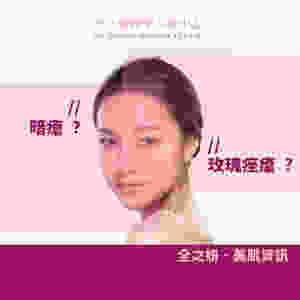 玫瑰痤瘡 暗瘡皮膚 暗瘡 暗瘡肌 暗瘡護理 ALLBEAUTY 全之妍