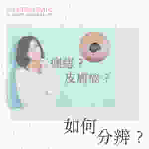 CO2 Laser脫疣 CO2 Laser脫墨 CO2 Laser脫癦 CO2激光脫疣 CO2激光脫墨 CO2激光脫癦 二氧化碳激光脫墨 二氧化碳激光脫癦 二氧化碳激光脫疣 脫墨醫生 脫癦醫生 脫疣醫生