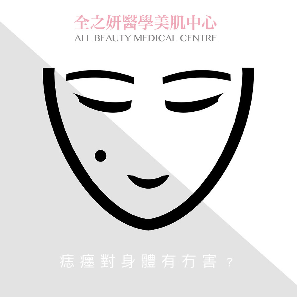 CO2 Laser脫疣 CO2 Laser脫墨 CO2 Laser脫癦 CO2激光脫疣 CO2激光脫墨 CO2激光脫癦 二氧化碳激光脫墨 二氧化碳激光脫癦 二氧化碳激光脫疣 脫墨醫生 脫癦醫生 脫疣醫生