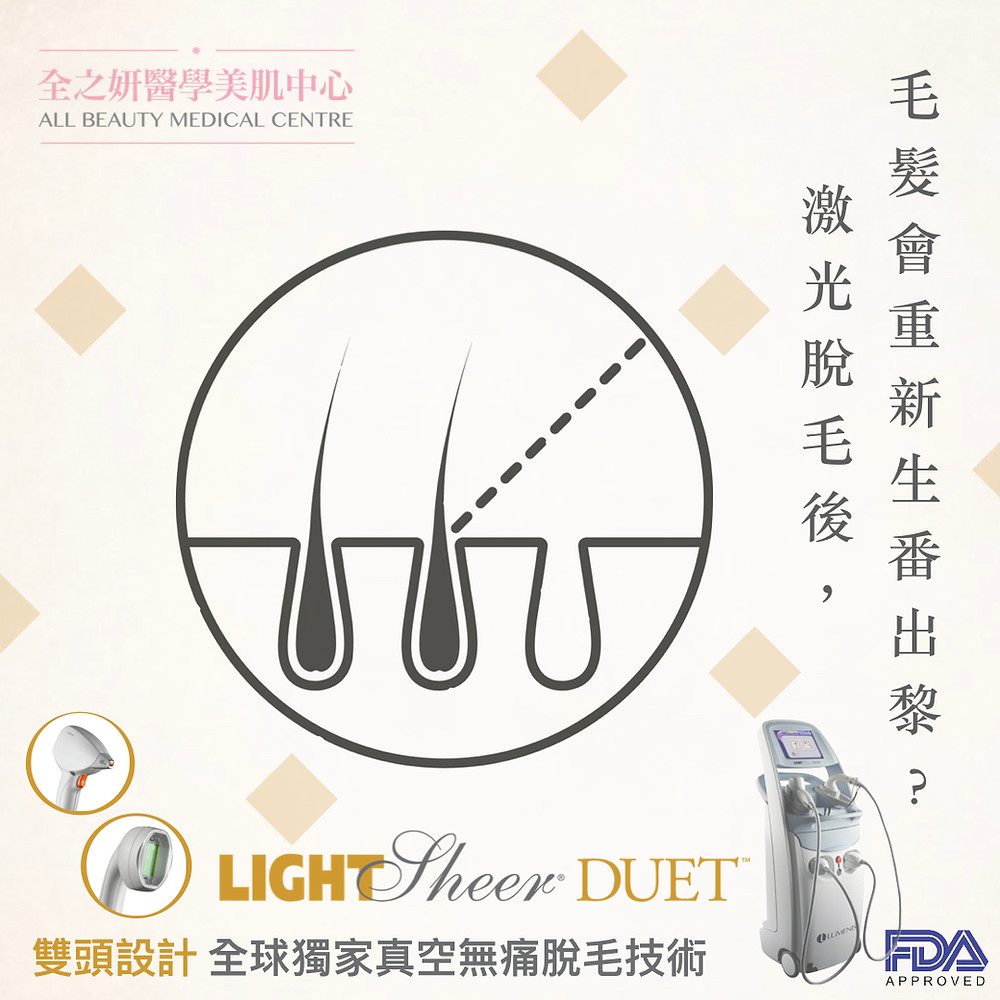 激光脫毛 無痛脫毛 ALLBEAUTY 全之妍 LUMENIS LIGHTSHEER CANDELA755