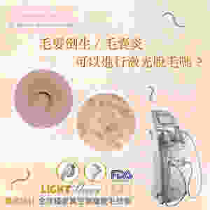 激光脫毛 無痛脫毛 ALLBEAUTY 全之妍 LUMENIS LIGHTSHEER CANDELA755 毛髮倒生 毛囊發炎