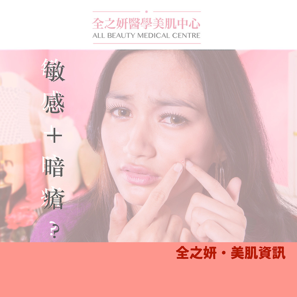敏感肌 生暗瘡 暗瘡皮膚 暗瘡 暗瘡肌 暗瘡護理 ALLBEAUTY 全之妍