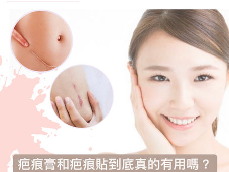 疤痕膏和疤痕貼到底真的有用嗎?了解各種去疤的原理 選對最有效的去疤方法!