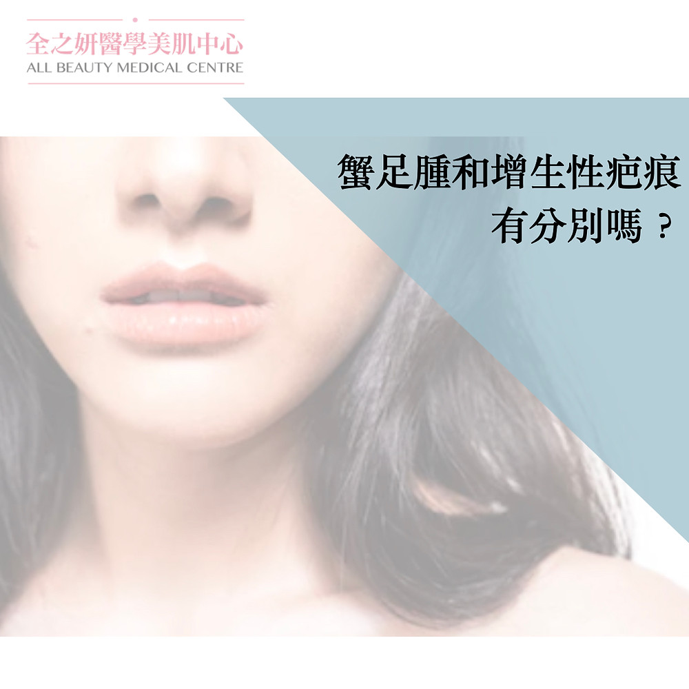 疤痕 疤痕治療 增生性疤痕 增生性疤痕治療 增生疤痕 增生疤痕治療 蟹足腫 蟹足腫 治療