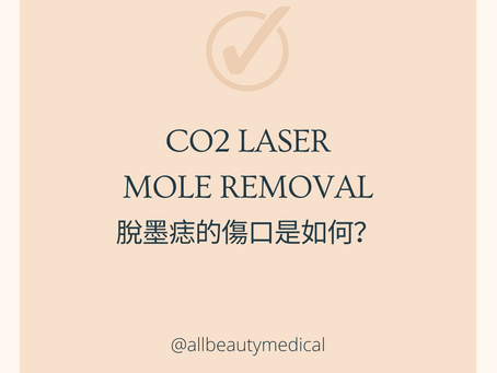 CO2 LASER 脫墨痣過程及傷口是如何