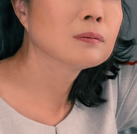 皮膚鬆弛.png