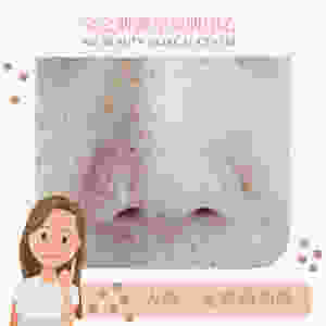 去斑 打斑 色斑 雀斑 咖啡斑 荷爾蒙斑 皮秒打斑 ALLBEAUTY 全之妍