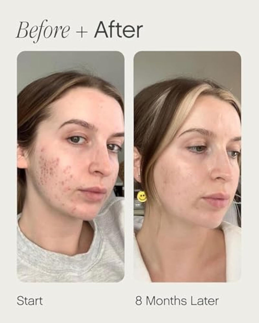 Thumbnail: Topicals Faded Brightening and Clearing Serum | Reduces Discoloration, Post-Ble
