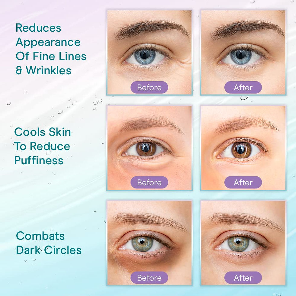 Thumbnail: Baebody Eye Gel Treatment Products, Under Eye Cream for Dark Circles and Puffin