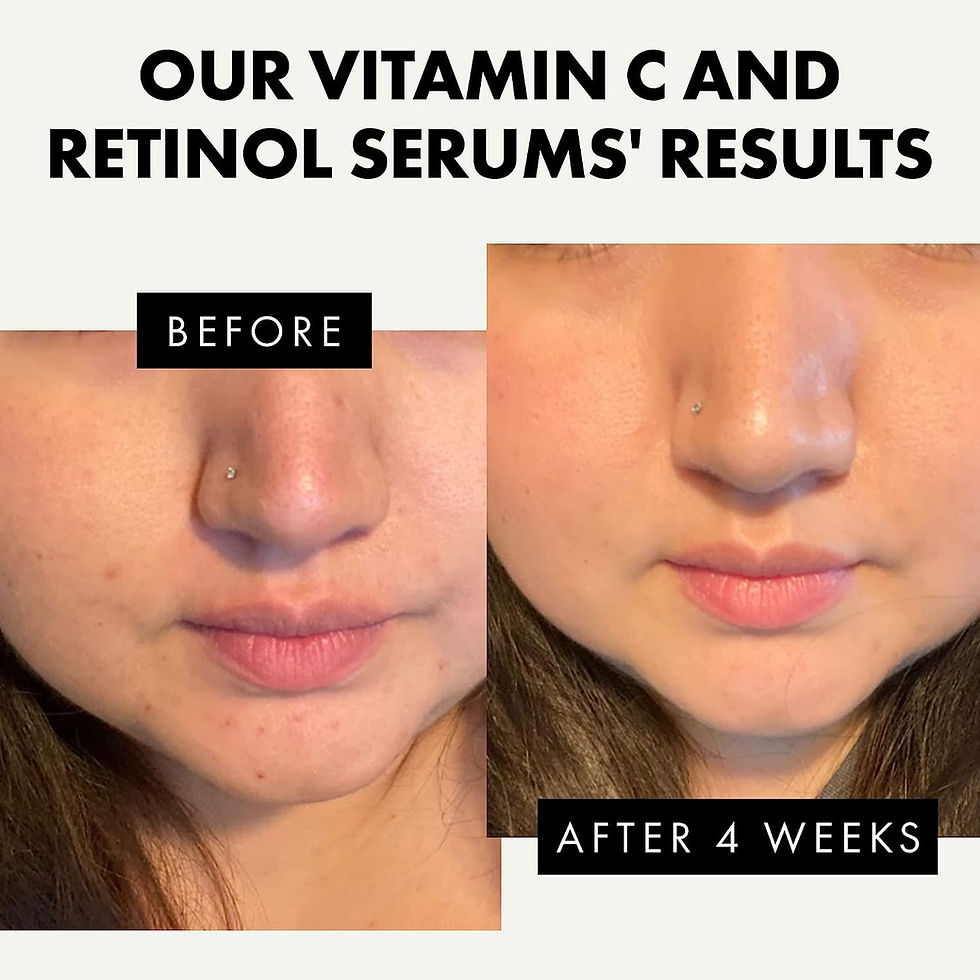 Thumbnail: 𝗪𝗜𝗡𝗡𝗘𝗥 𝟮𝟬𝟮𝟯* Retinol Serum & Vitamin C Serum, Ret
