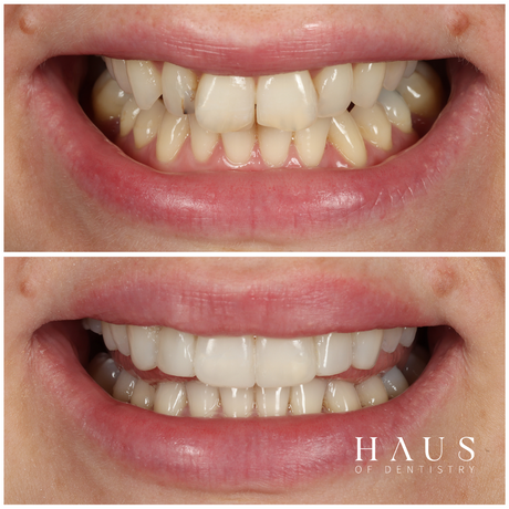 haus