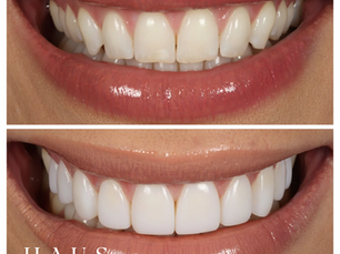 The Importance of Oral Dental Health for Your Overall Health