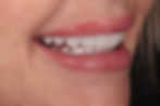 dental