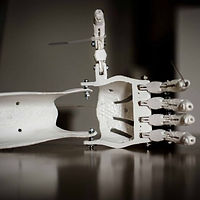 prostetic-proteza-3d-print-druk-r-ka-me-