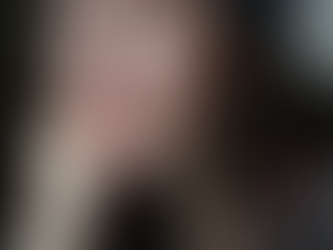 Cáncer ya no significa lo mismo que hace años. Aquí la explicación.