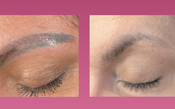 ProLift PMU & Tattoo Removal_edited_edit