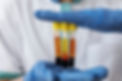 front-view-doctor-holding-vials-prp-treatment-1024x681.jpg